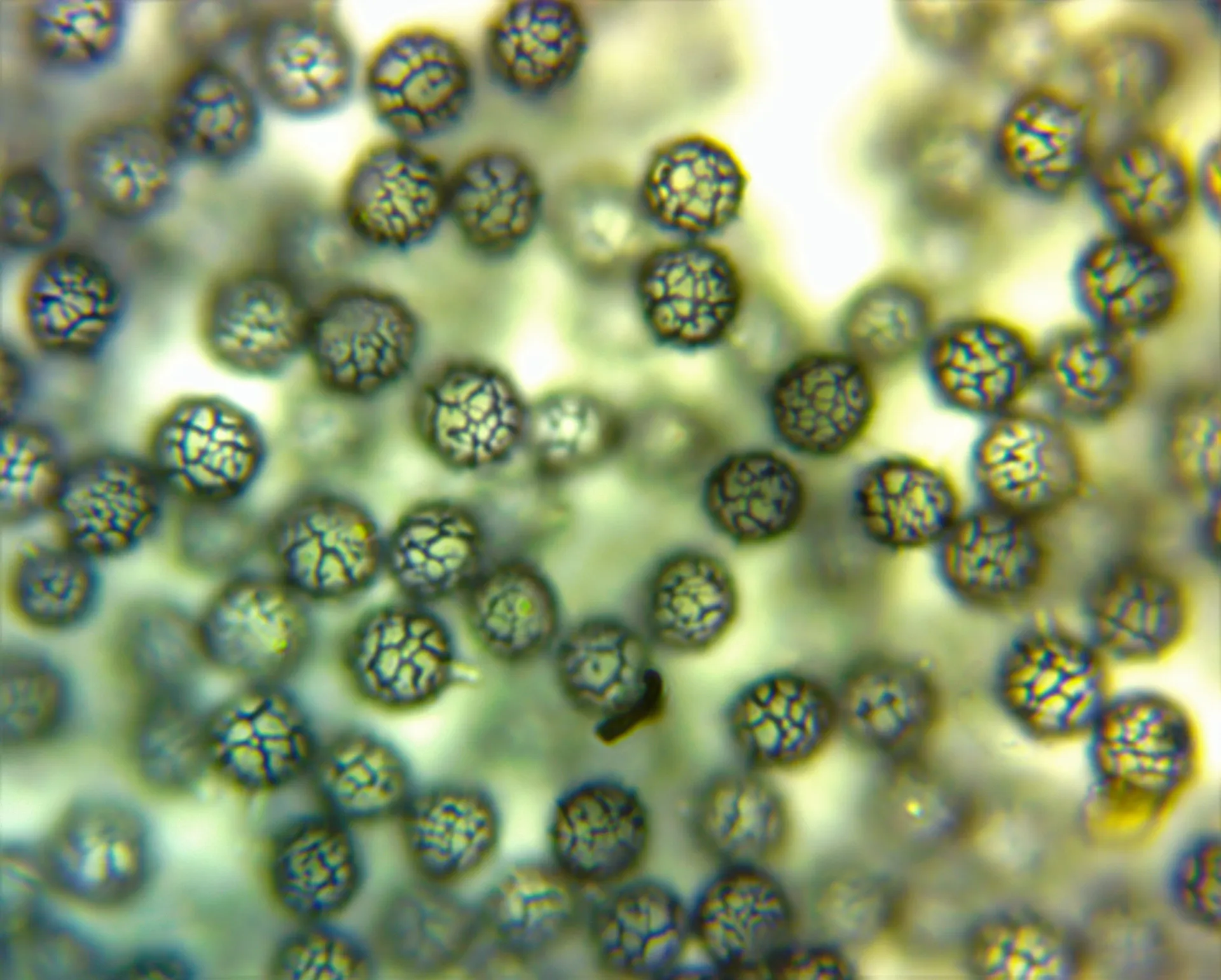 Microscopía de Lactifluus oedematopus - esporas Melzer (1)